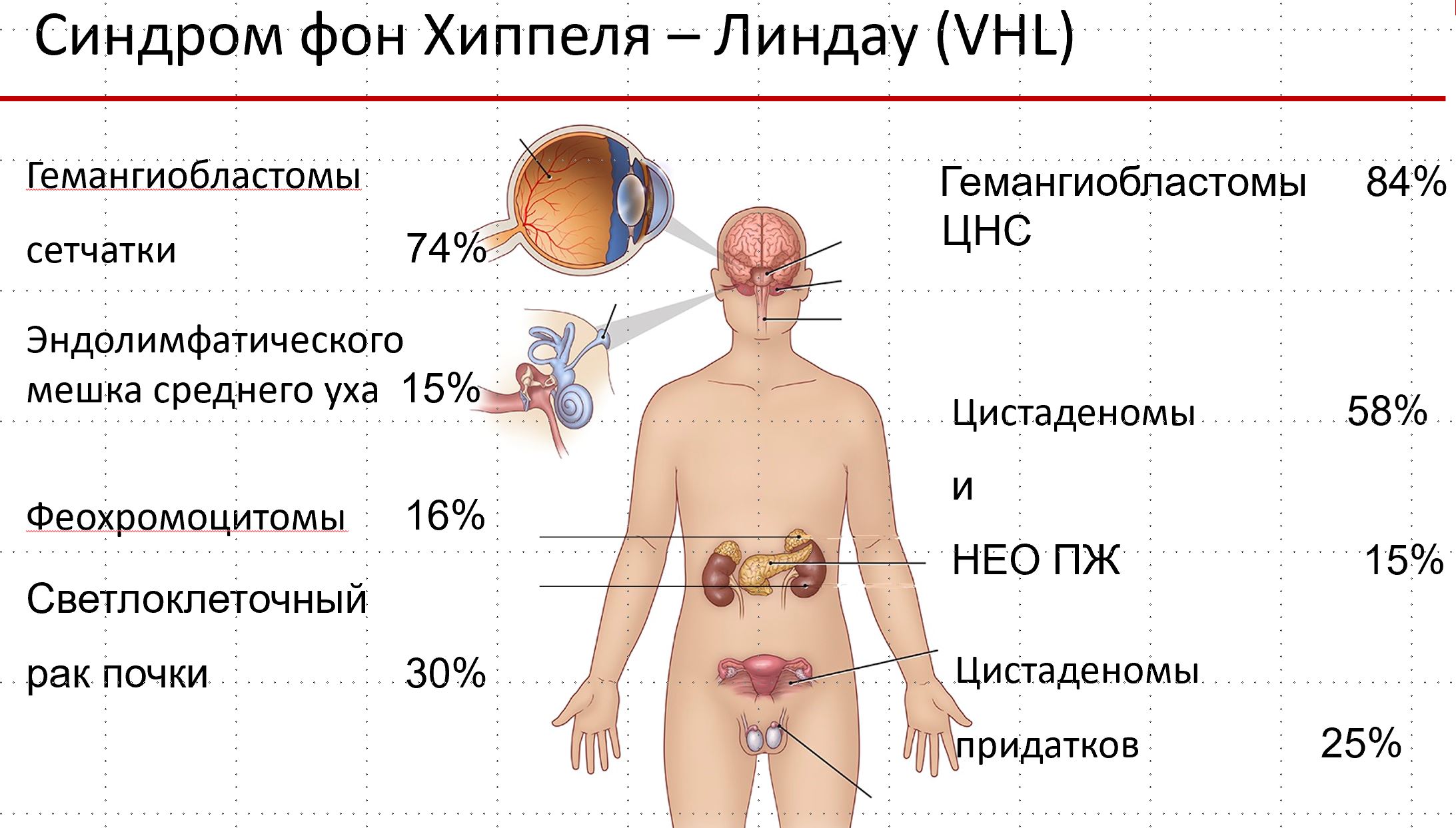 Von hippel lindau usmle